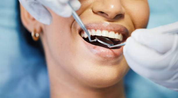 Best Urgent Tooth Repair  in Vashon, WA